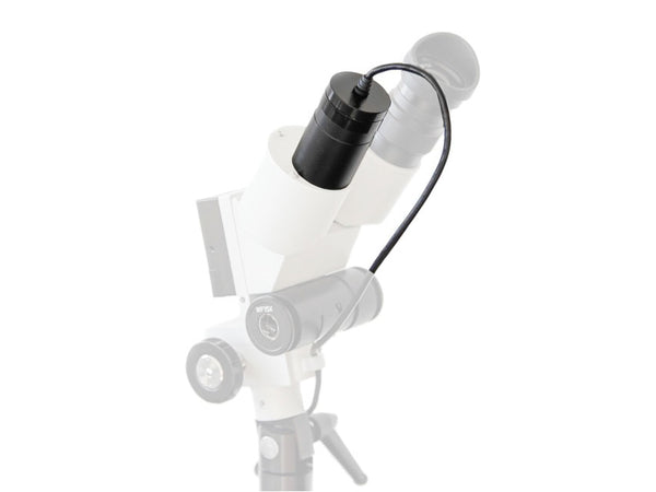 Telecamera Digitale per Colposcopio USB
