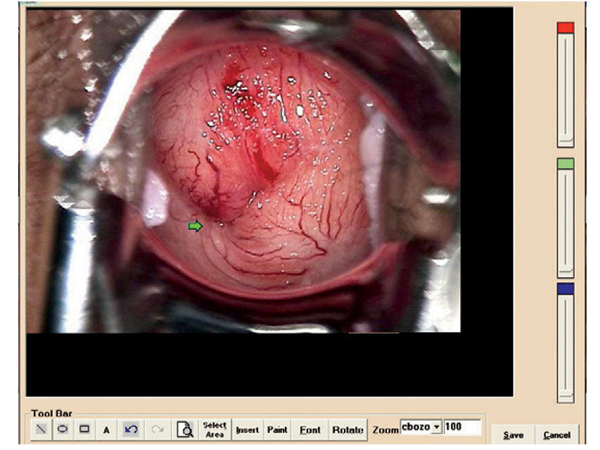 Software per 29620, 29622, 29600 - GEF Medica