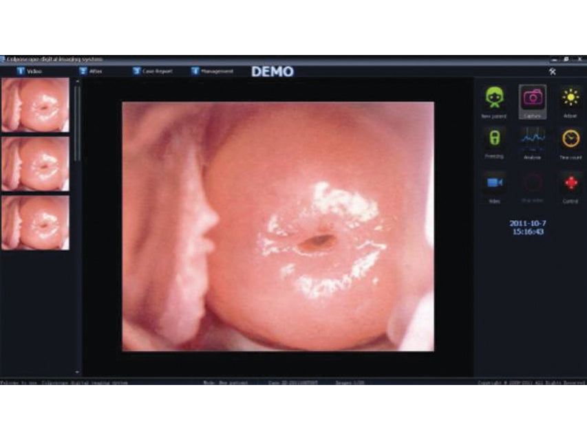 Software per 29624, 29625, - GEF Medica