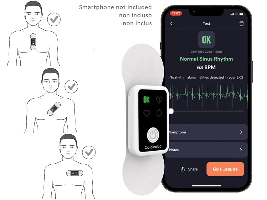 ECG Cardionica a 1 Canale con Afib e Bluetooth _a