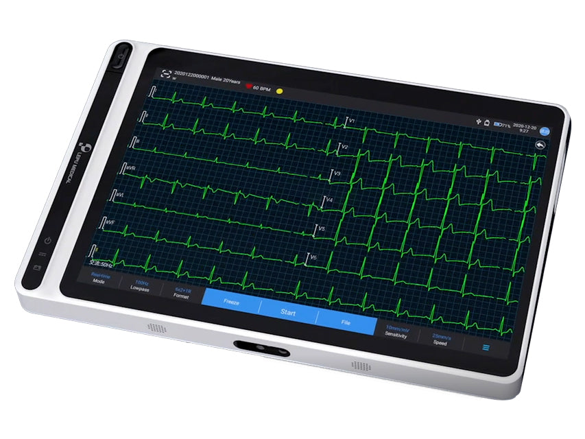 Neo Ecg S120 Tablet Ecg