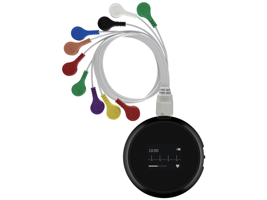 Sistema DI Monitoraggio Holter