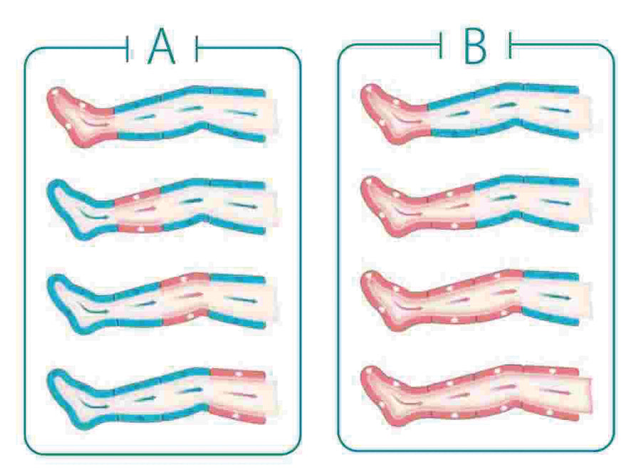 Pressoterapia Lem Solo Pompa, vista 5