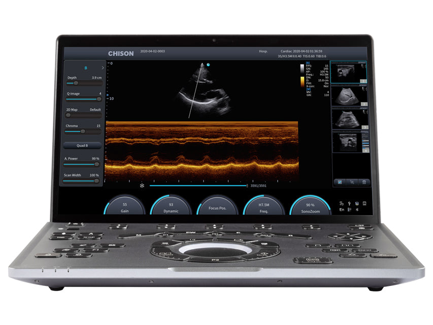 Ecografo portatile wireless Chison SonoAir 30