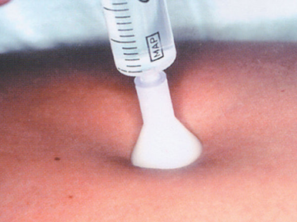 S.i.t. Terapia Iniezione Cutanea 31g 0,26x2,5mm - Conf. 25 pz. - immagine 1