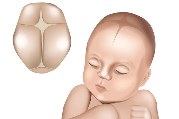 Dent Baby Dent Baby