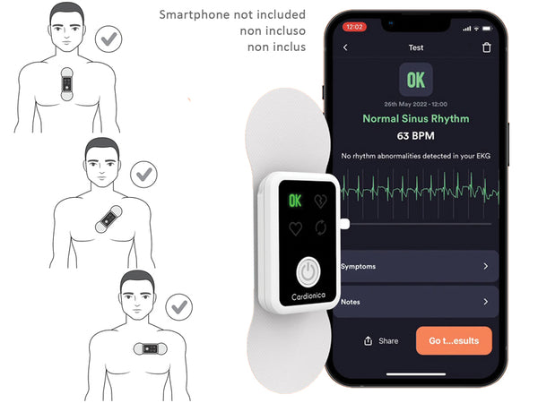 ECG Cardionica a 1 Canale con Afib e Bluetooth _a