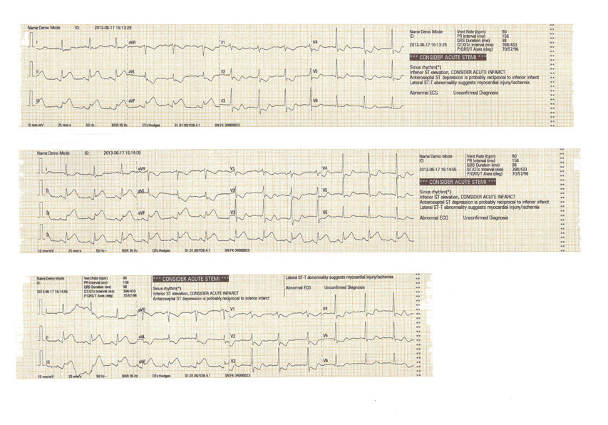 ECG Mindray Beneheart R3 _b