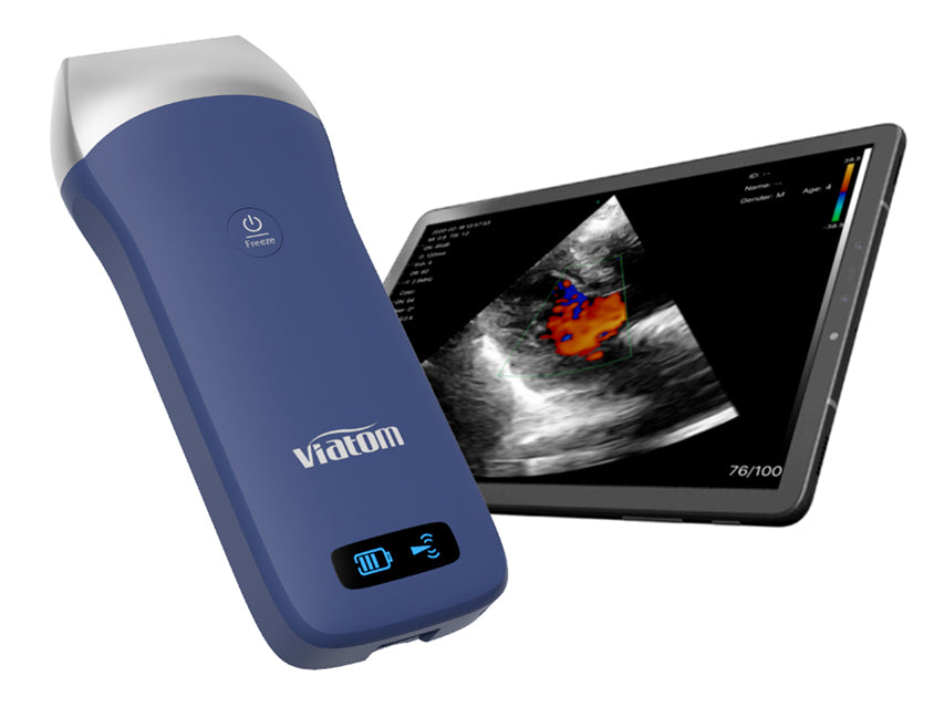 Ecografo Portatile Lineare Wireless Viatom _a
