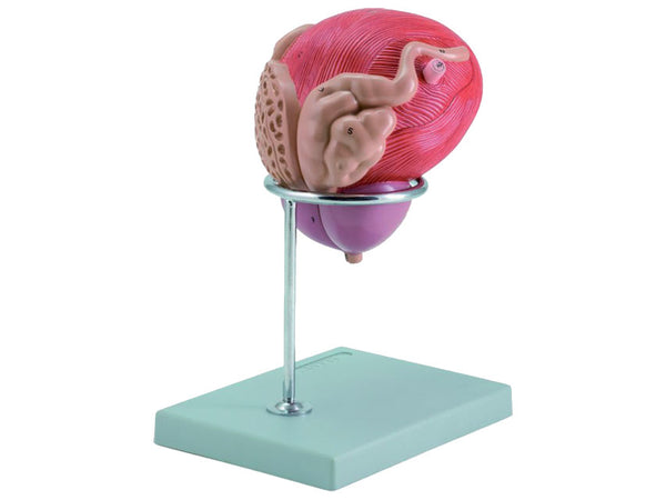 MODELLO VESCICA + PROSTATA 2 parti 3X
