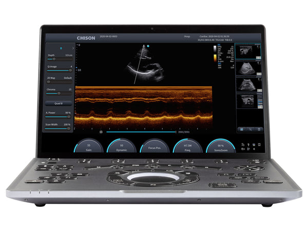 Ecografo portatile wireless Chison SonoAir 30
