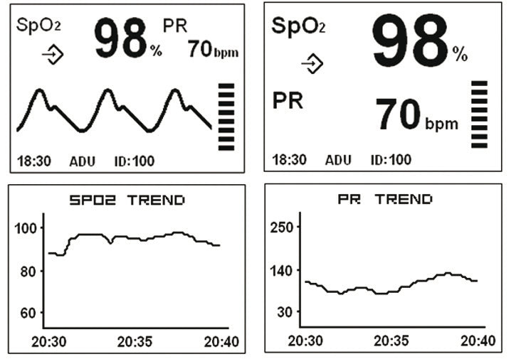 Pulsiossim Lcd Dimed con Allarmi H100B | GEF Medica