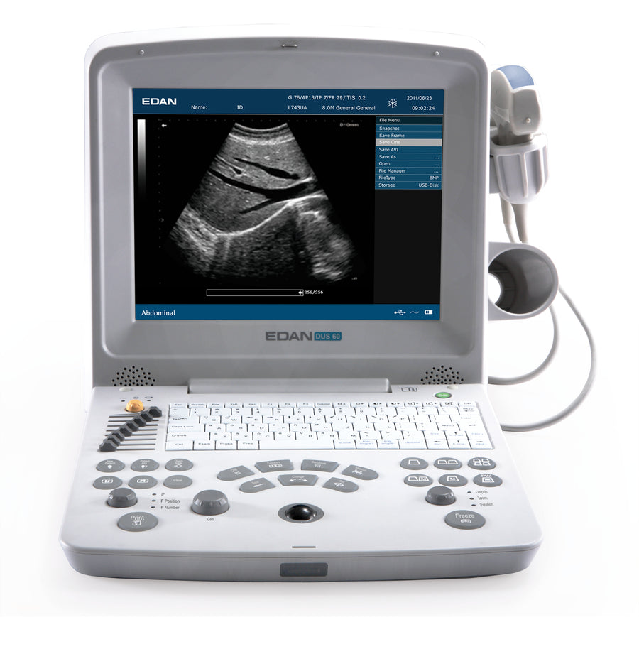 Ecografo Portatile Dimed Dus 60 1 Sonda Conv | GEF Medica