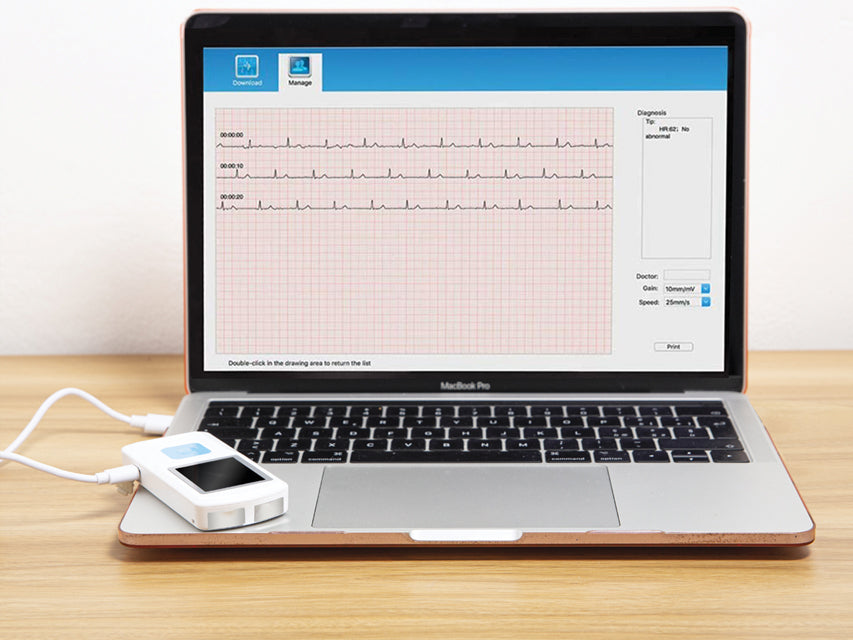 Tracciato ECG visualizzato su computer portatile